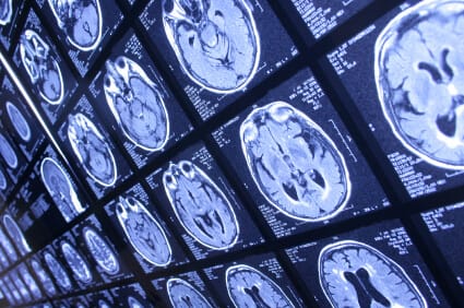 Genetics Can Lead to Cocaine Addiction